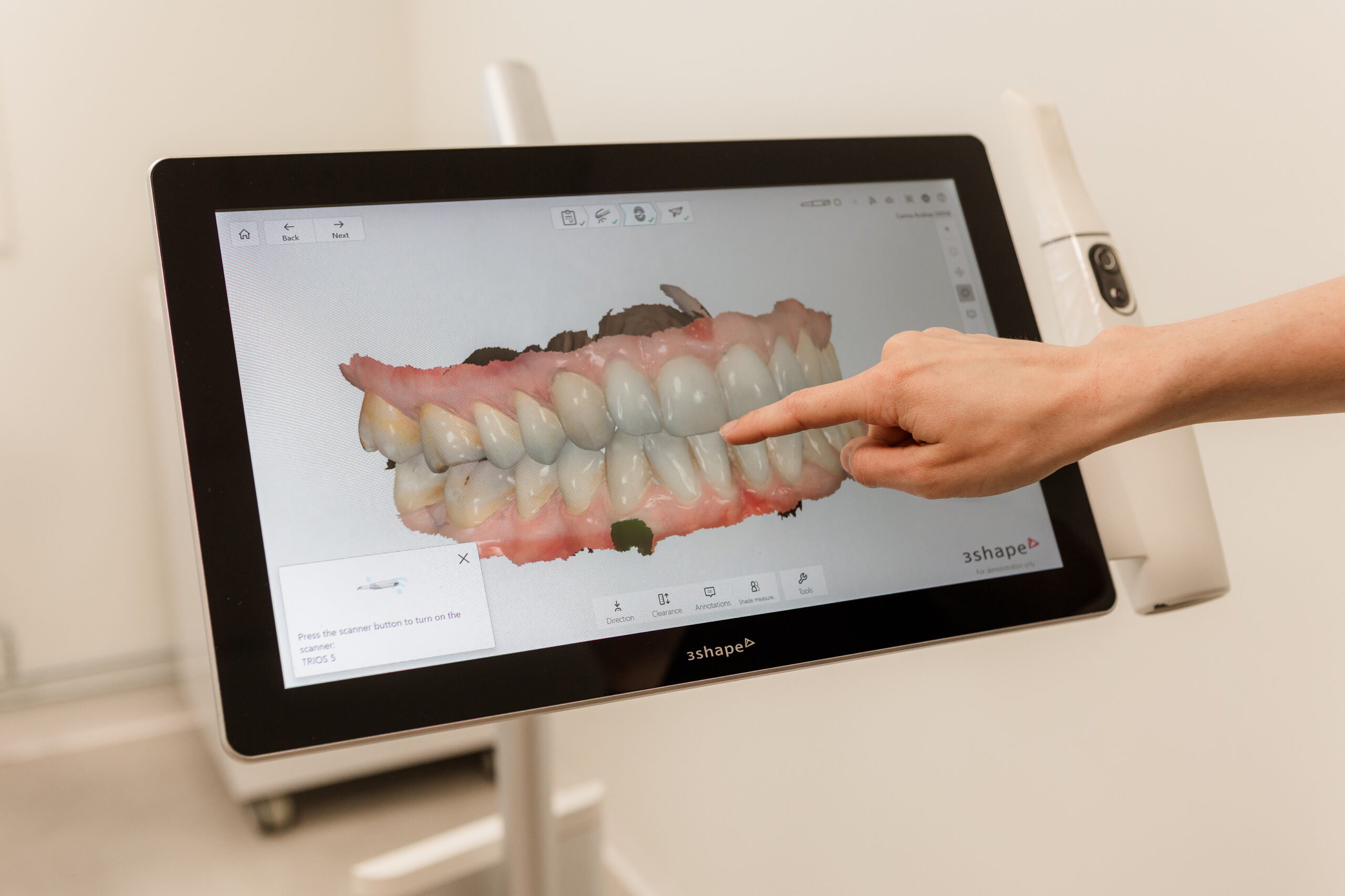 Digital 3D-modell av et tannsett på en skjerm